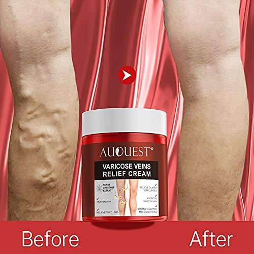 Varicose Veins Relief Cream for Legs