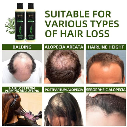 Rosemary Hydrolyzed Shampoo | Hair Growth & Anti-Dandruff Scalp Treatment