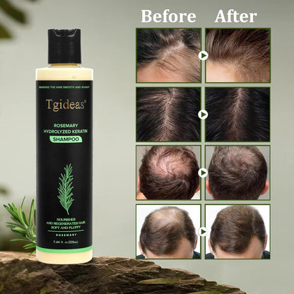 Rosemary Hydrolyzed Shampoo | Hair Growth & Anti-Dandruff Scalp Treatment