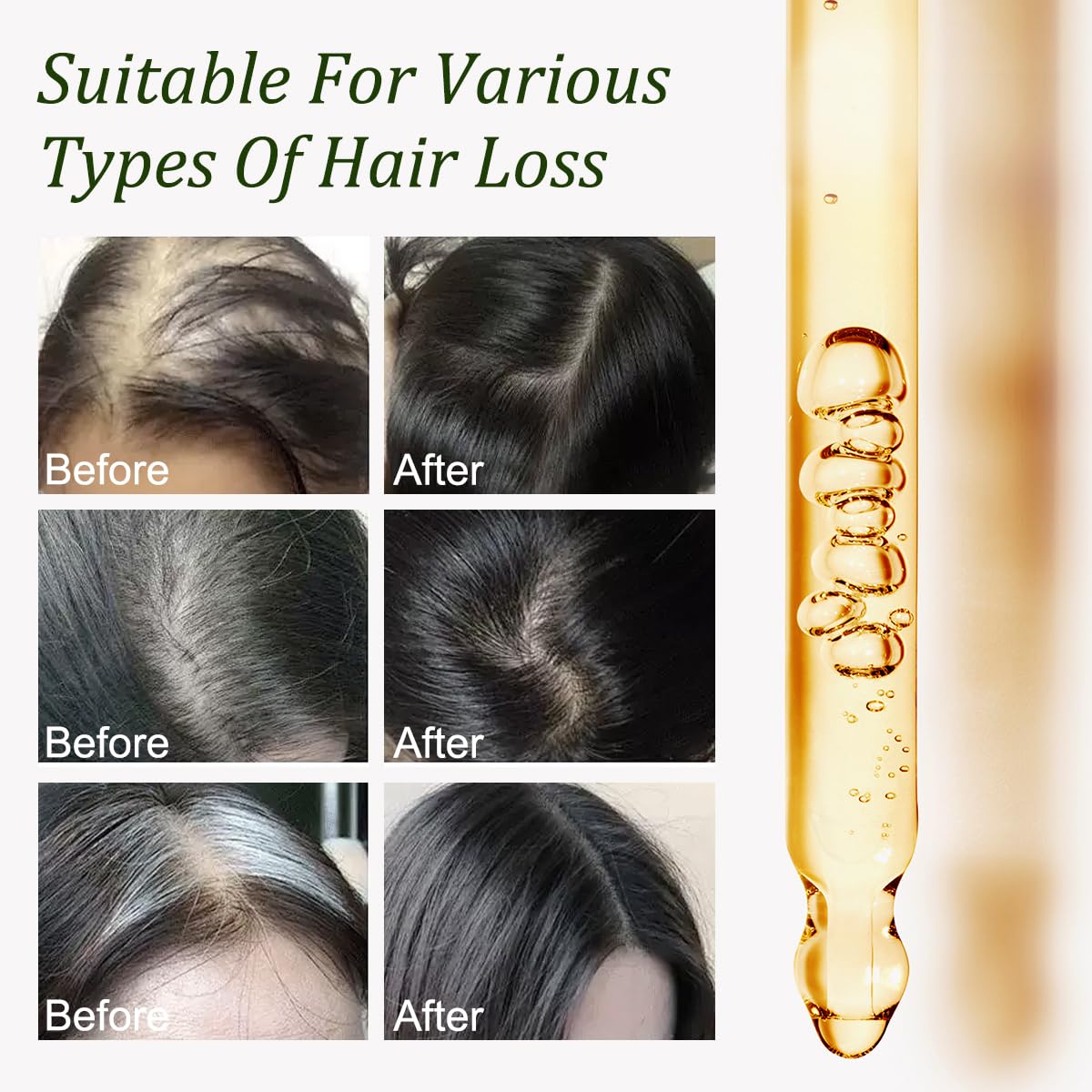 Batana Hair Oil – Grow, Repair & Shine